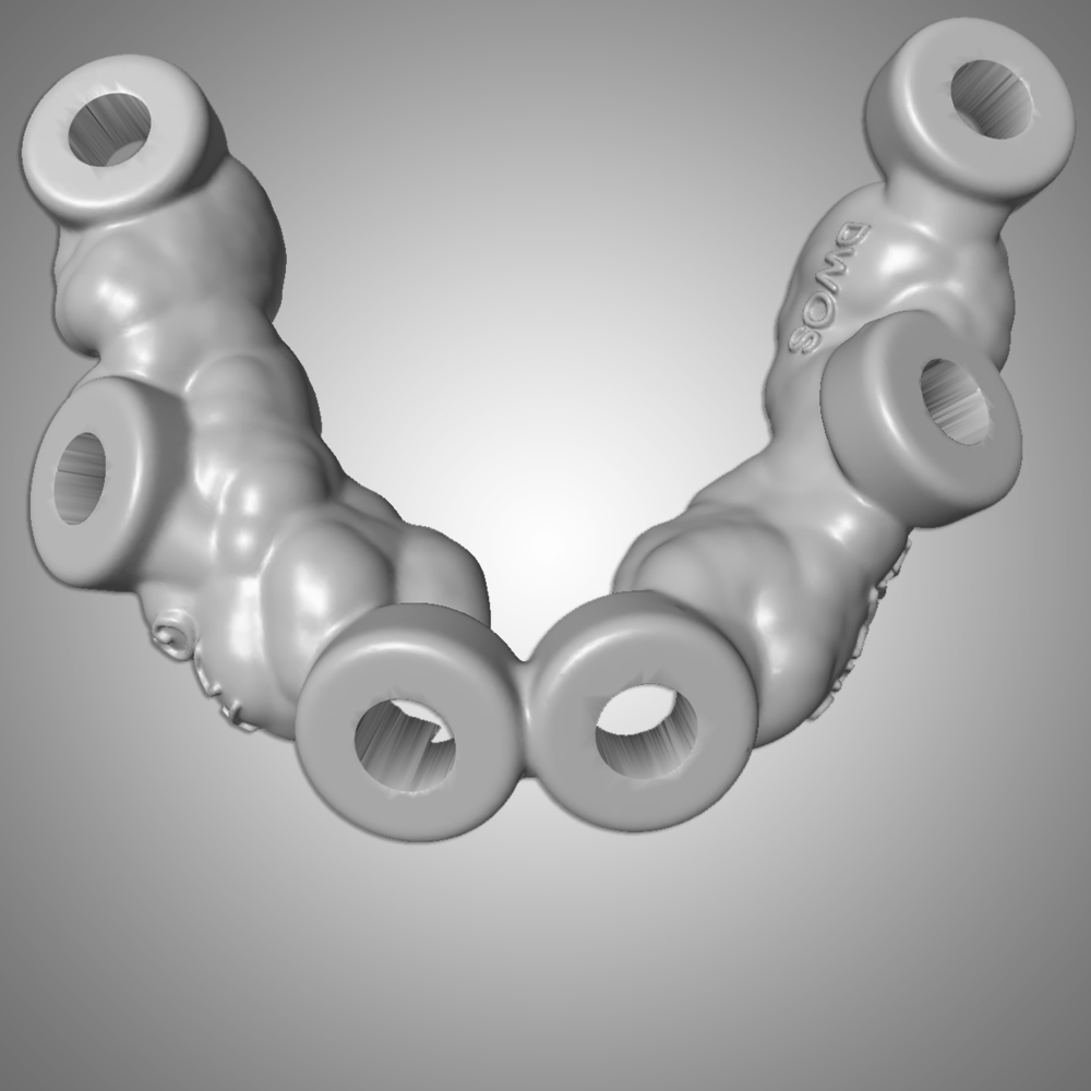 Dijital Cerrahi-Rehber