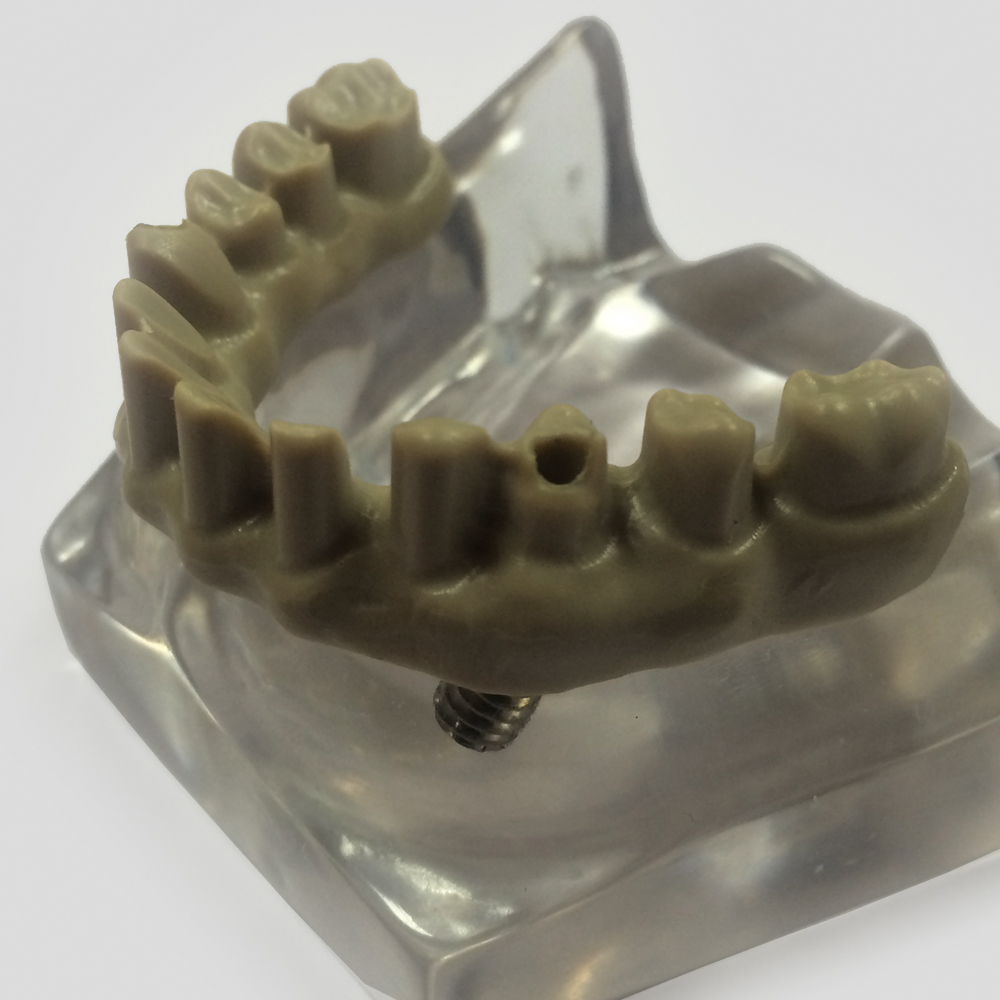 Dijital Vida-Tutuculu Köprü